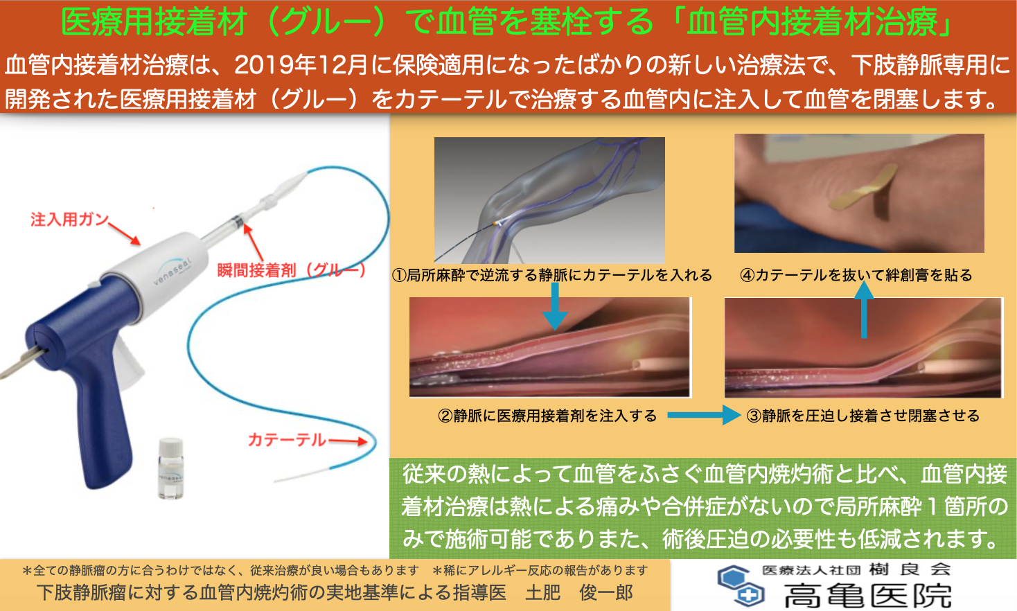 『まき爪に対するワイヤー式矯正治療3TO(VHO) 』　好評いただいております！　